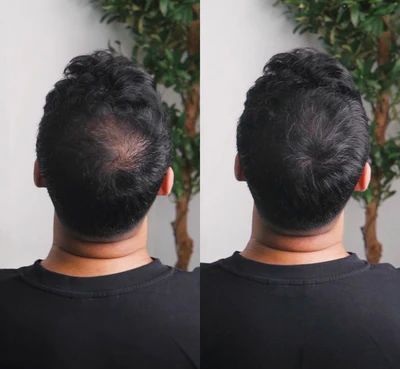 مقاوم للماء 💦 سرّ المشاهير لملء الفراغات – نتيجة طبيعية مستحيل يكتشفها حد !