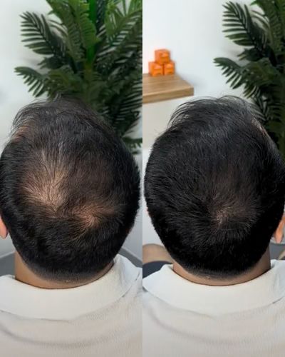 مقاوم للماء 💦 سرّ المشاهير لملء الفراغات – نتيجة طبيعية مستحيل يكتشفها حد !