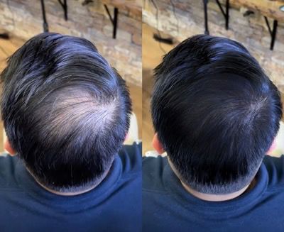 مقاوم للماء 💦 سرّ المشاهير لملء الفراغات – نتيجة طبيعية مستحيل يكتشفها حد !