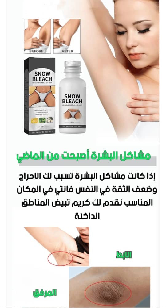 ✨ Snow Bleach crème – تبييض مواضع خاصة وآمنة بالكامل